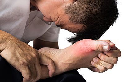 Bunion Pain, The Bunion Institute of Los Angeles