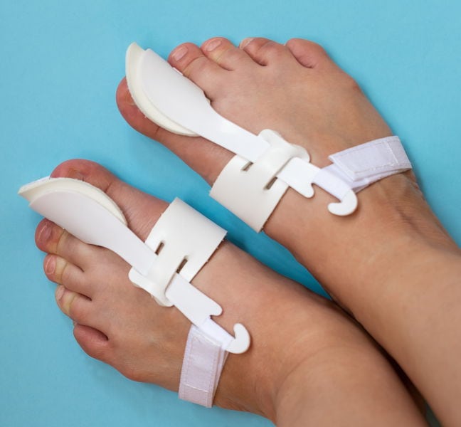 Bunion splints