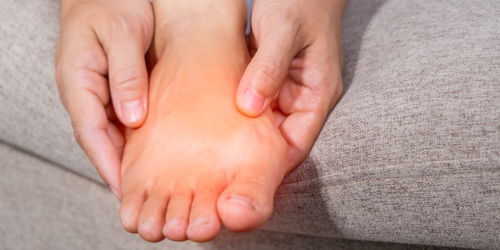 Crazy At-Home Bunion Treatments People Actually Try