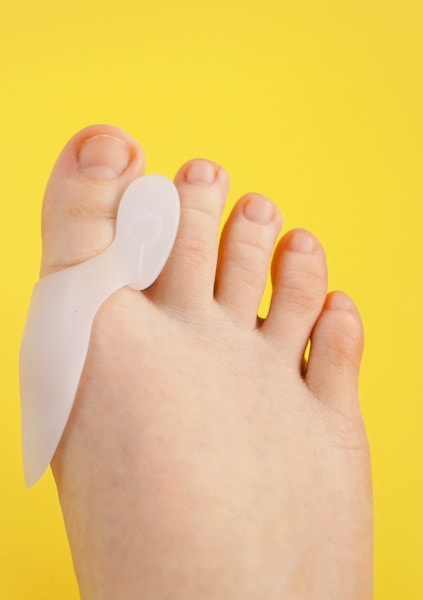 Weird At-Home Bunion Treatments