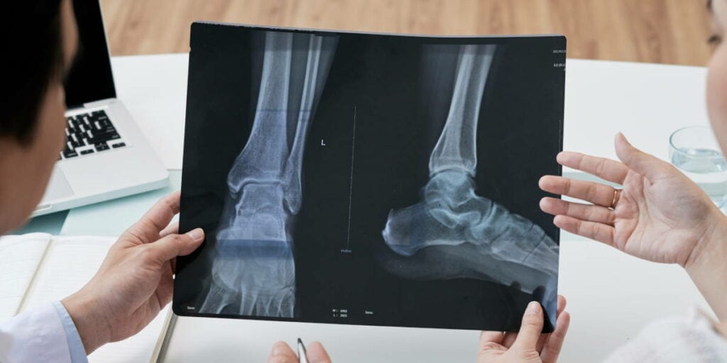 Doctor showing foot and ankle X-ray