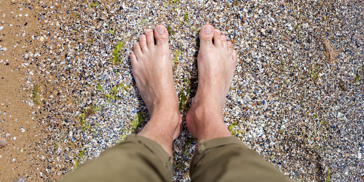 How to Stop Bunions from Forming: A Guide for High-Risk Feet