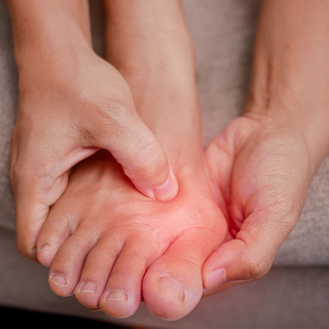 Managing bunion pain